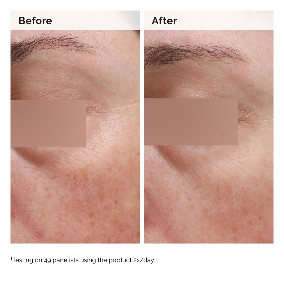 niacinamide-5-face-and-body-emulsion-f9 2024-08-23-ORD-Nia-5pct-Face-Body-B-A-Elasticity-Global-02-1x1.jpg
