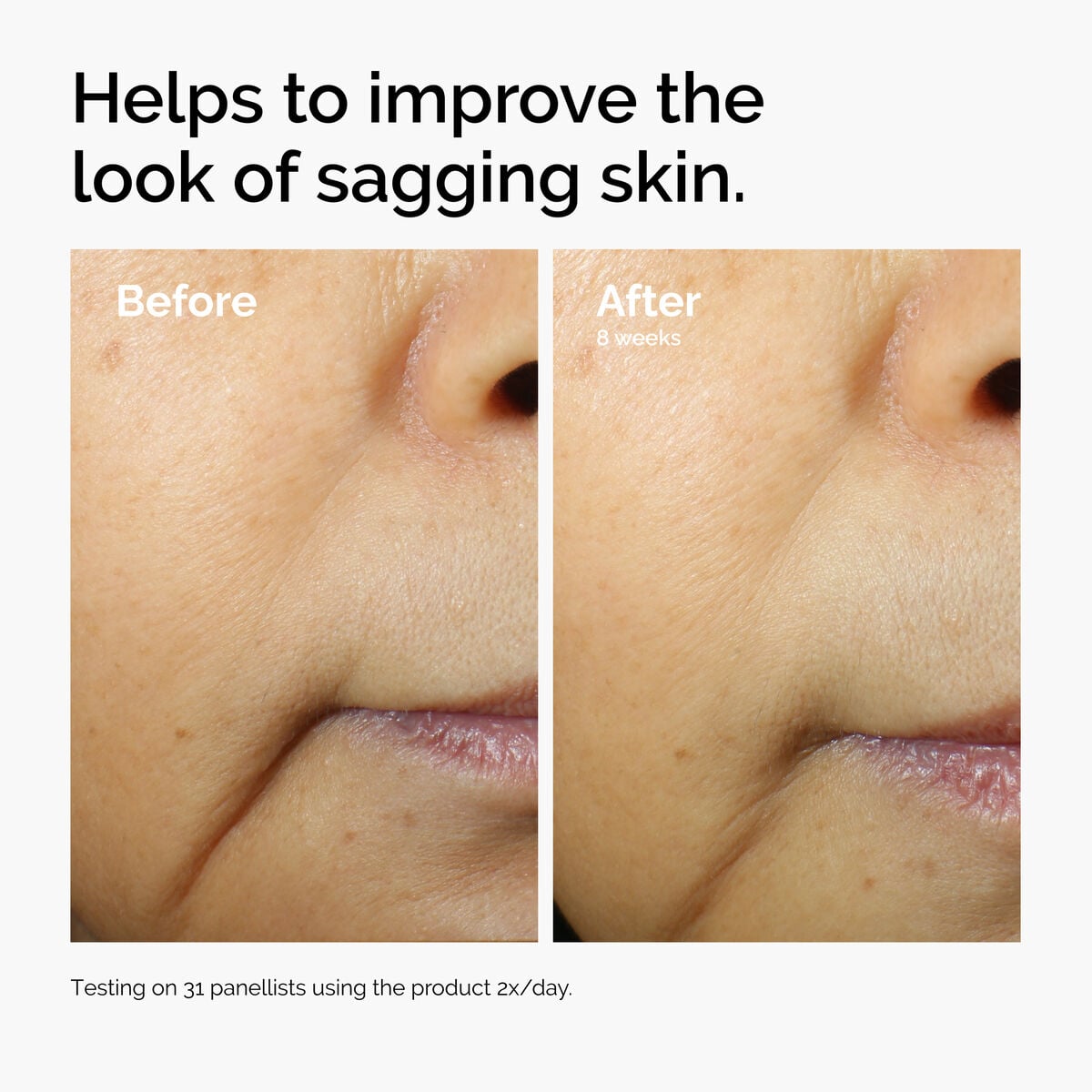 caffeine-3-escin-1-face-serum-o2 ord-caffeine-3pct-escin-1pct-face-serum-before-after-sagging.jpg
