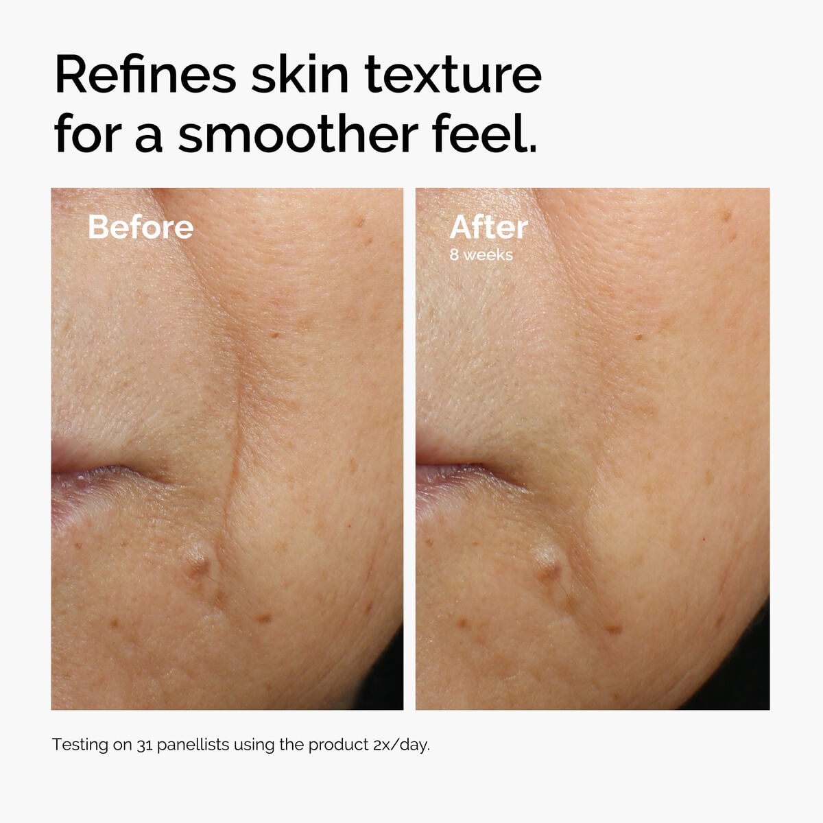 caffeine-3-escin-1-face-serum-o2 ord-caffeine-3pct-escin-1pct-face-serum-before-after-texture.jpg