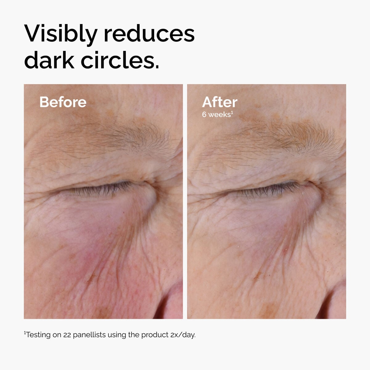 caffeine-solution-5-egcg-eye-serum-d9 ord-caffeine-solution-egcg-dark-circles-before-after.jpg