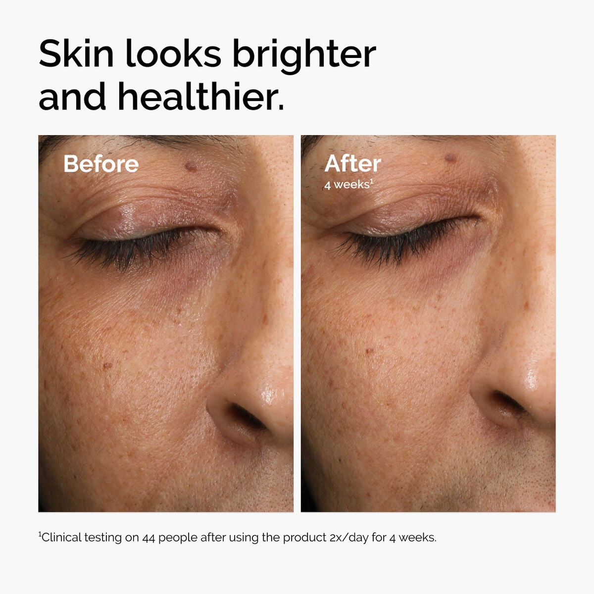 multi-antioxidant-radiance-serum-x4 ord-mars-before-after-healthy.jpg