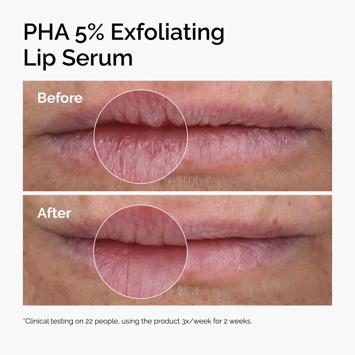 pha-5-exfoliating-lip-serum-v5 ord-pha-5pct-lip-exfoliating-serum-before-after.jpg